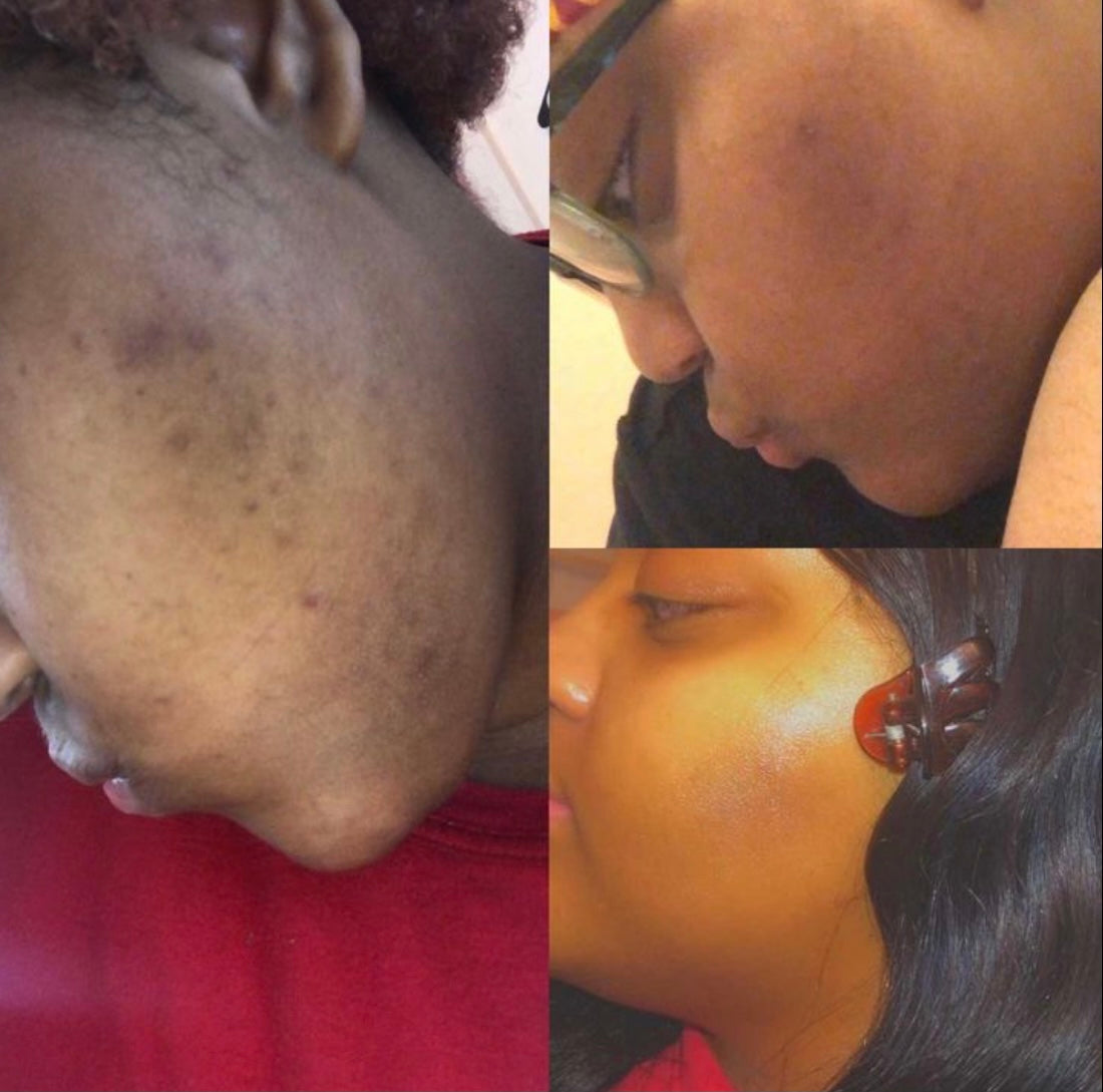 Green Goddess Face Bar