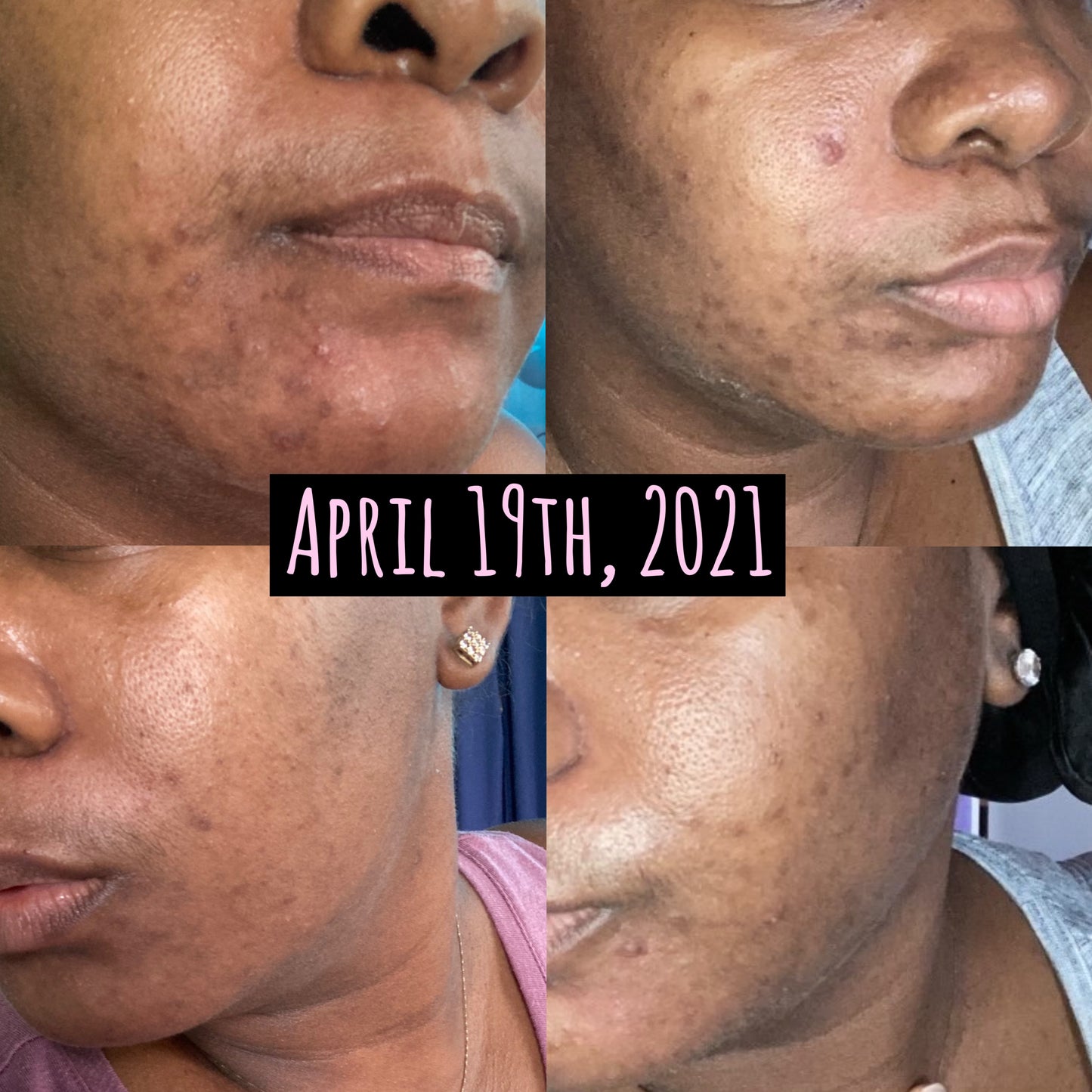 Green Goddess Face Bar